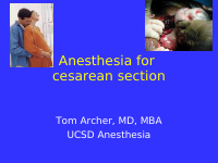 Anesthesia for cesarean section.ppt